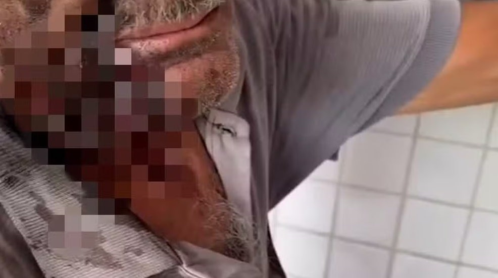 Idoso é agredido com socos e tiro no rosto após reclamar de som alto