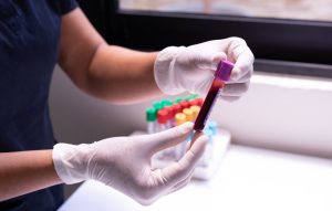 Cientistas desenvolvem exame que vai além do diagnóstico de Alzheimer