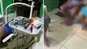ÁUDIO: Técnico em prótese é flagrado atuando como dentista no MA