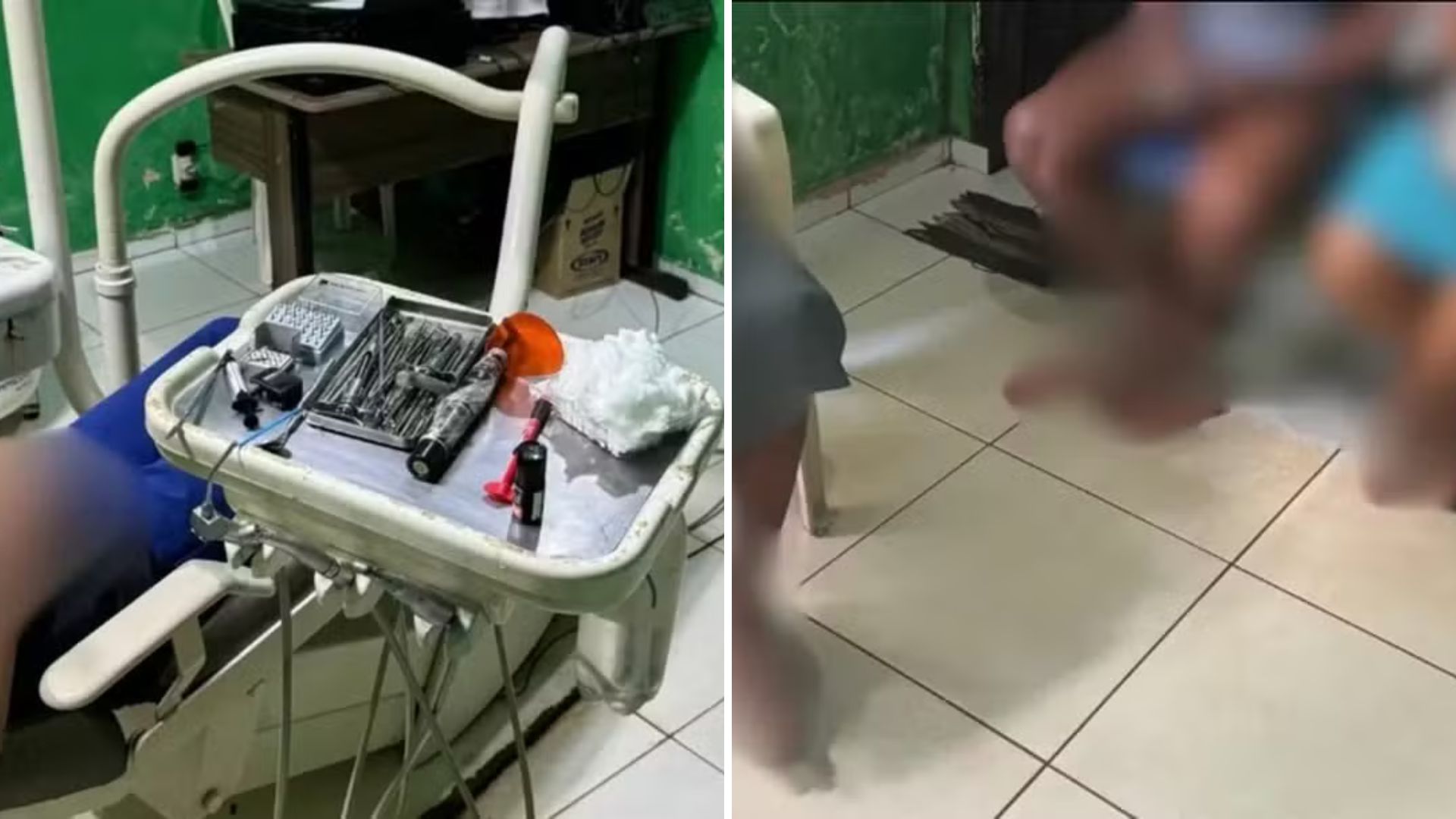 ÁUDIO: Técnico em prótese é flagrado atuando como dentista no MA