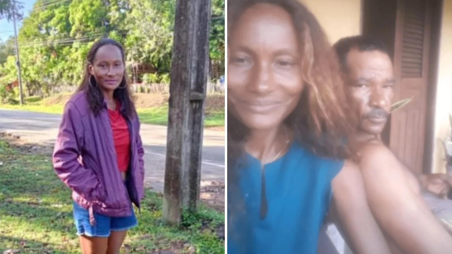 Morre mulher que teve 90% do corpo queimado pelo marido