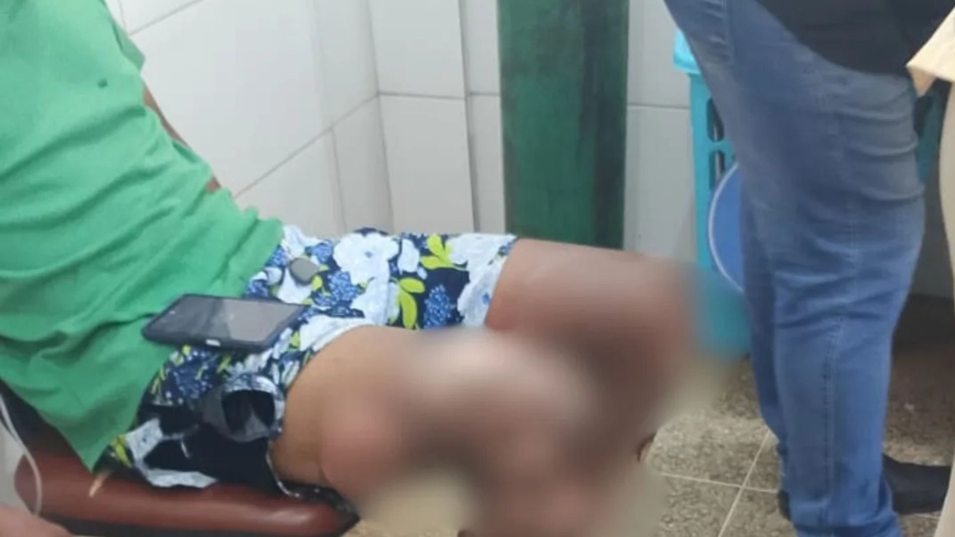 Explosão em restaurante deixa cinco feridos no MA