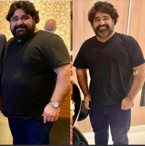 Cantor sertanejo exibe transformação após emagrecimento