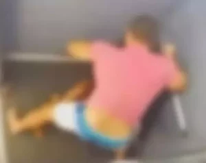 Agressão no elevador: Rosto de vítima é refeito com malha de titânio