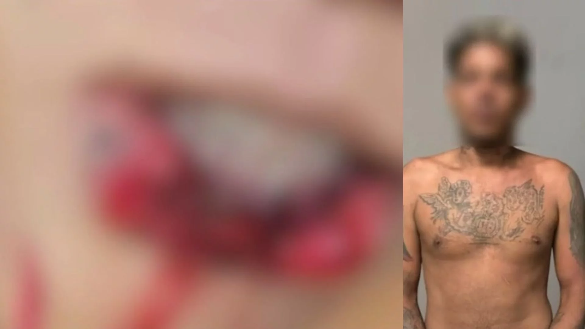 Homem é preso após atacar namorada e arrancar parte da boca