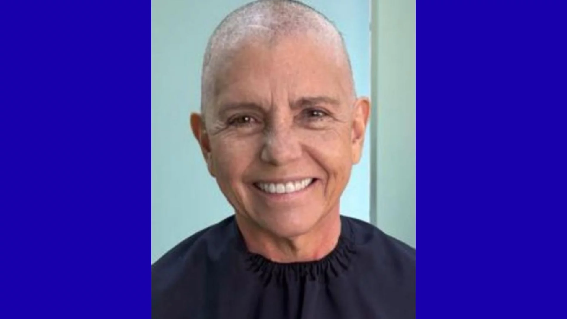 Roseana Sarney exibe foto sem cabelos após diagnóstico de câncer