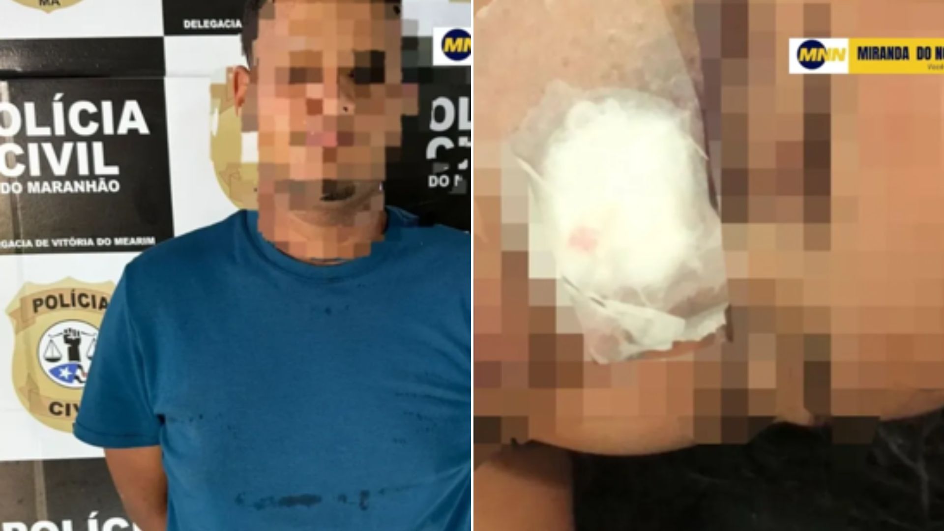 Homem é preso suspeito de atirar no rosto de ex-namorada de 16 anos