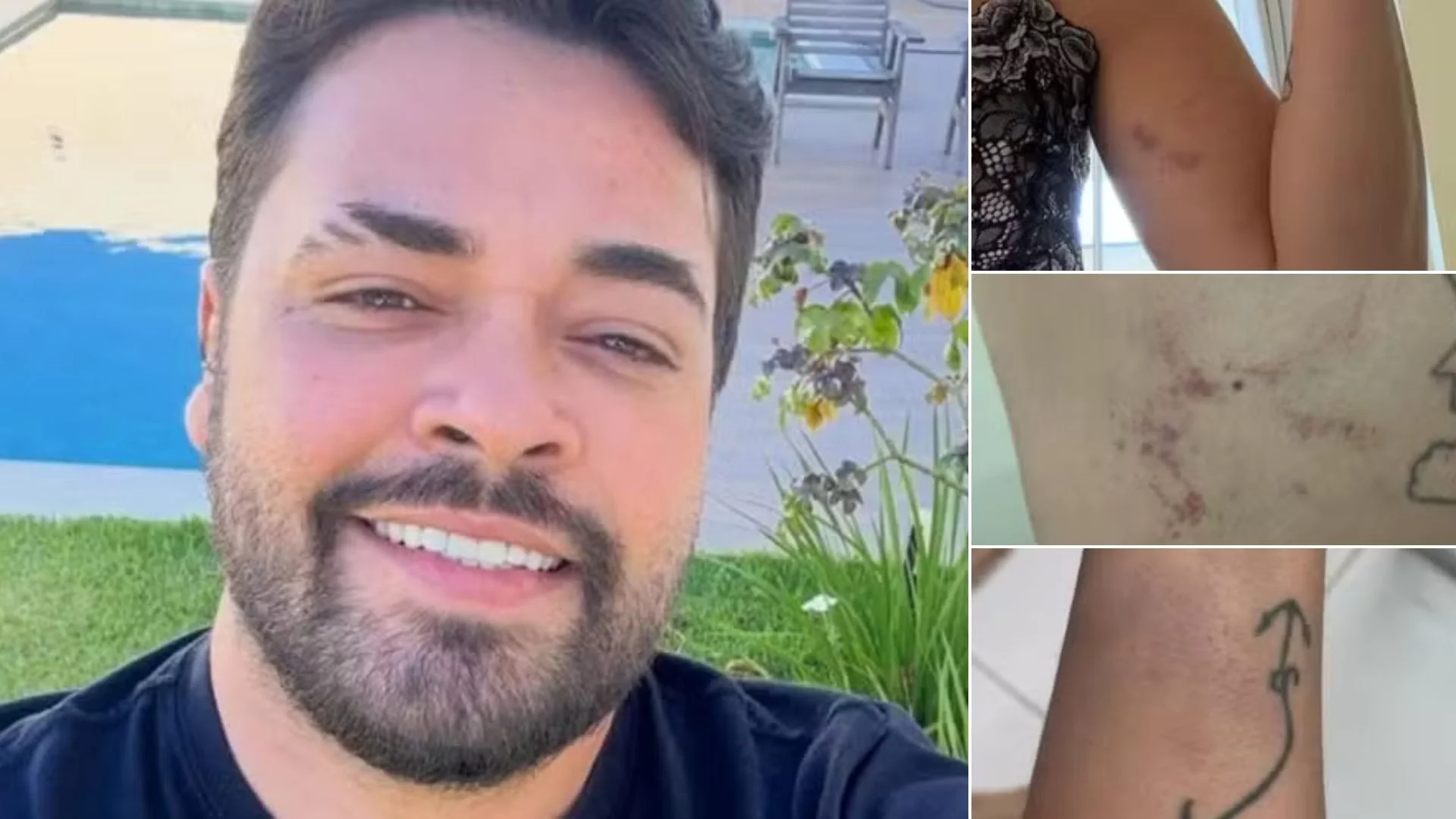 Cantor é investigado por suspeita de agredir esposa em São Luís