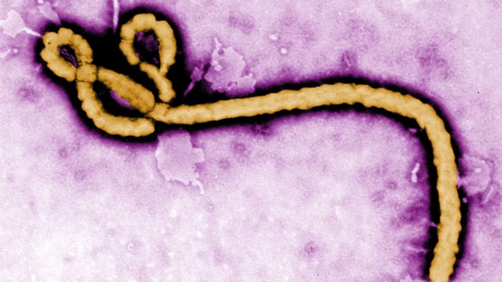França registra primeiro caso de ebola no país